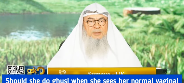 Must I do ghusl when I see normal vaginal discharge or wait for white thread like discharge?