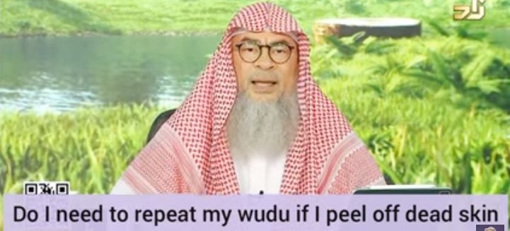 Do I have to renew my wudu if I peel off dead skin or shave my head?