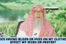 Does having blood or pus on my clothes affect my wudu or prayer? #islam #islamic assim al hakeem