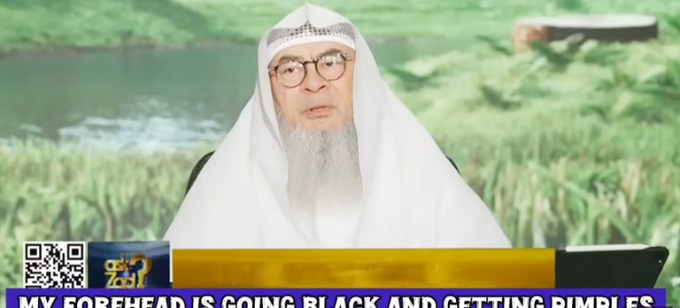 My forehead is going black & getting pimples from making dua in sujood, what to do?