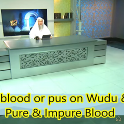 Does Human Blood & Pus on body or clothes invalidate Wudu & Prayer?