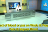 Does Human Blood & Pus on body or clothes invalidate Wudu & Prayer?