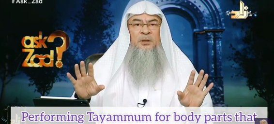 Performimg tayammum if you cannot do ghusl due to skin condition