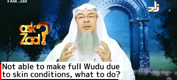 Not able to do full wudu due to skin condition, what to do?
