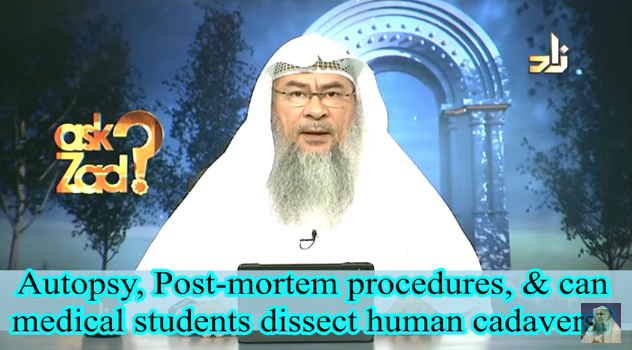 autopsy-post-mortem-procedure-medical-students-dissecting-human