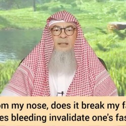 Does nose bleeding invalidate my wudu & fasting?